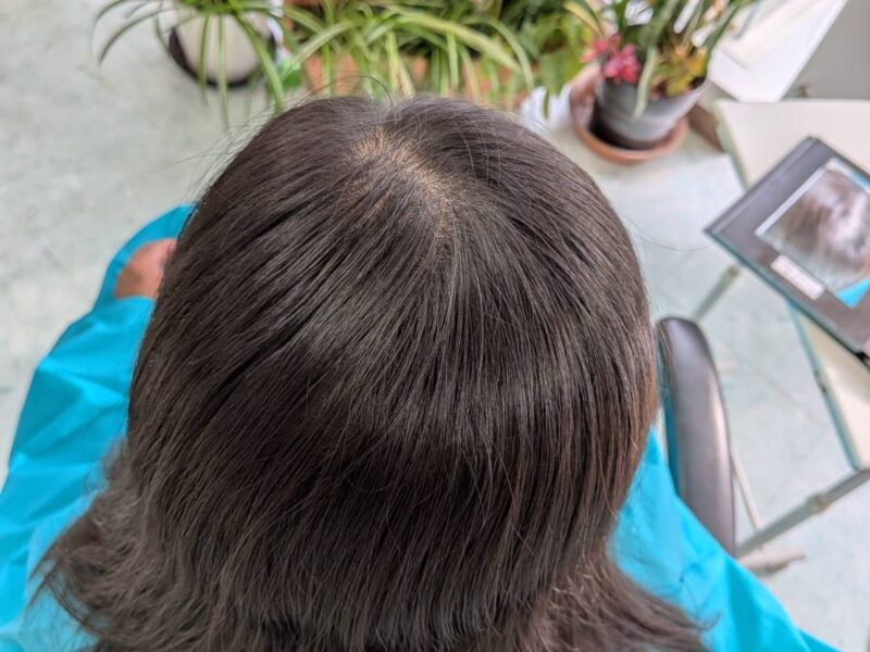 本日のリセッターカット